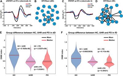 Criticality in the Healthy Brain